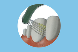 فناوری بولتدان